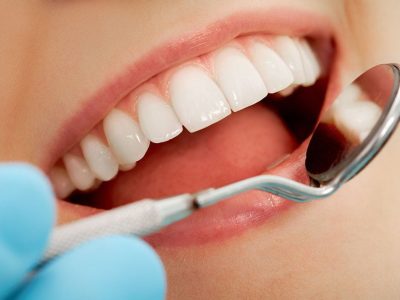 Close-up of patient’s open mouth during oral checkup with mirror near by